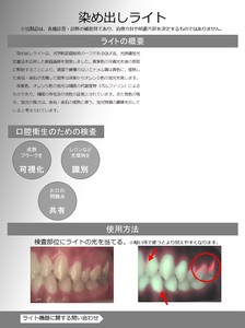 染め出しライト　歯垢着色液を必要としない新しい歯垢・歯石の可視化方法