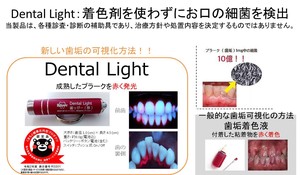 Dental　Light（デンタルライト）　歯垢着色液を必要としない新しい歯垢・歯石の可視化方法